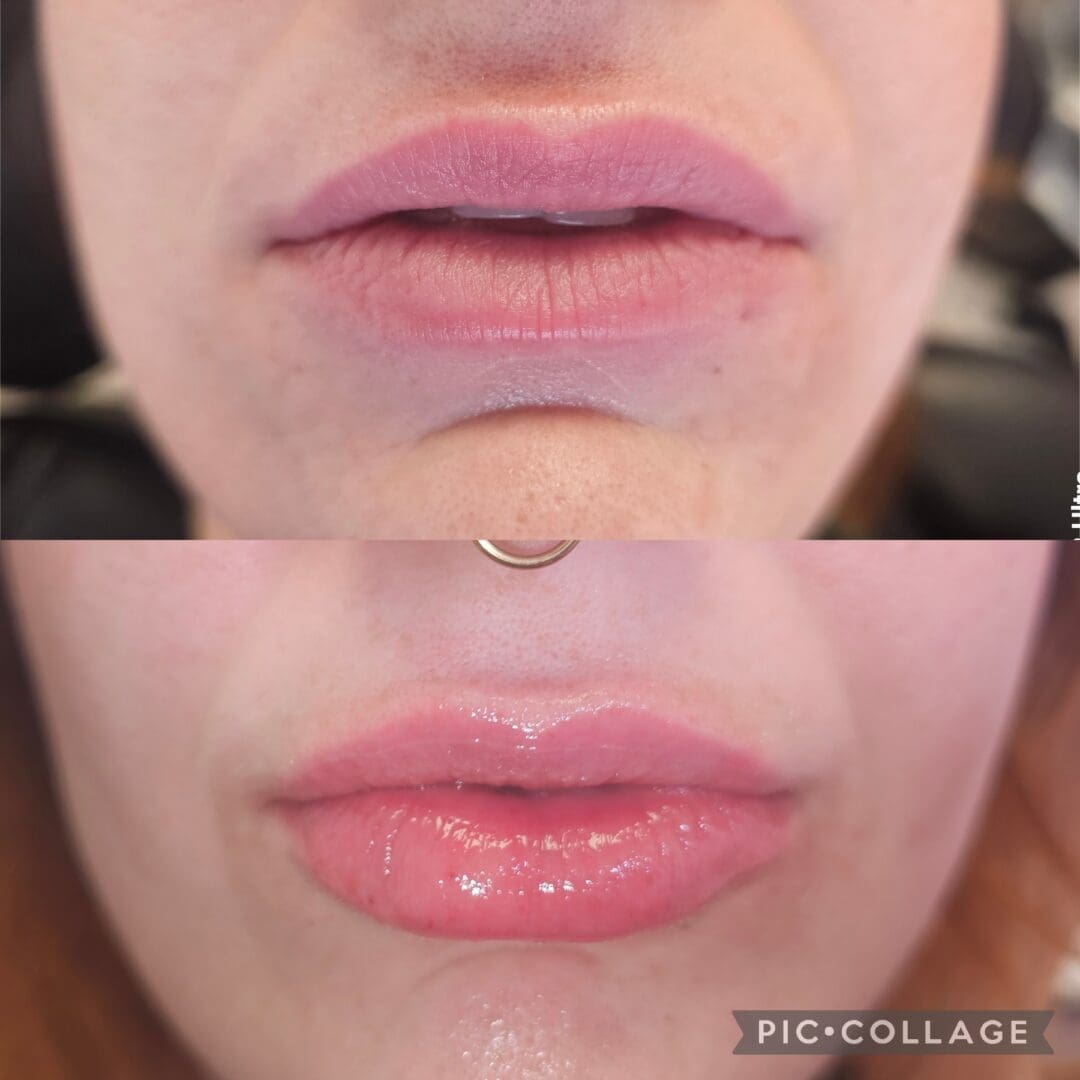 A before and after photo of a woman 's lips.