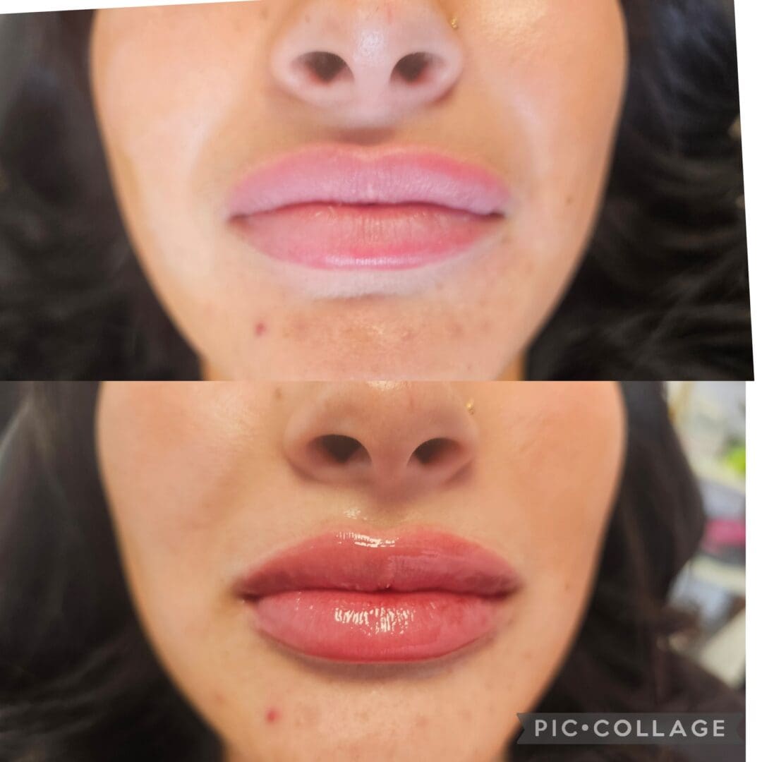 A before and after picture of the lips